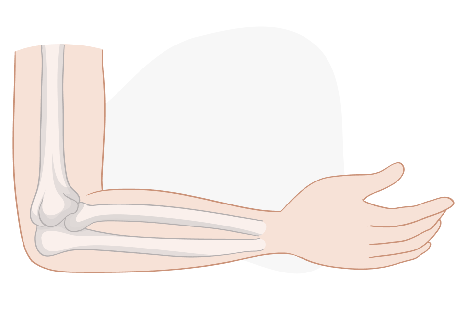 Upper limb